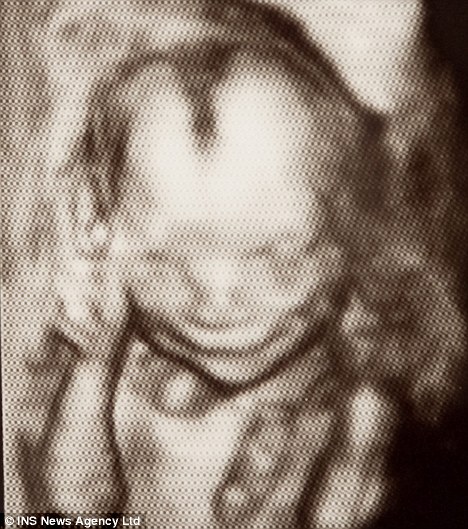 Descubrimiento de que los fetos sonren a las 17 semanas